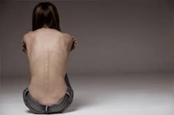 Woman with eating disorder with her back towards camera